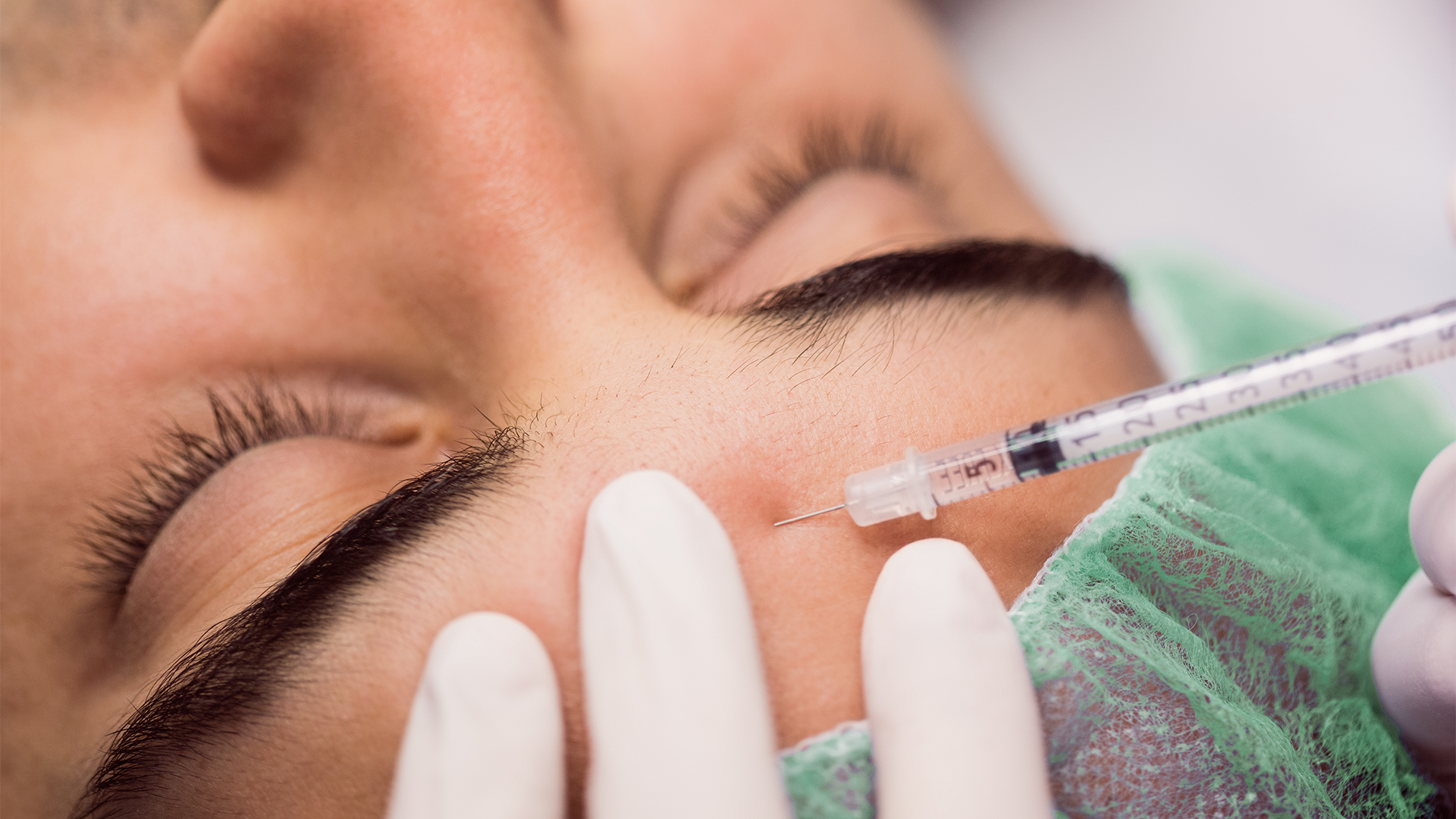 Botox injection administered on the forehead by a specialist
