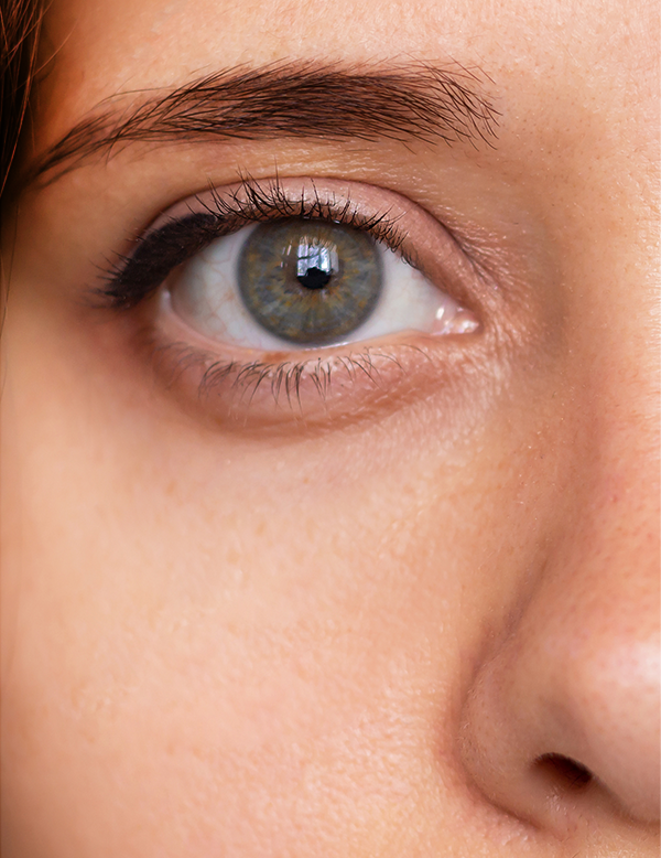 Brighter and smoother under eye area after treatment