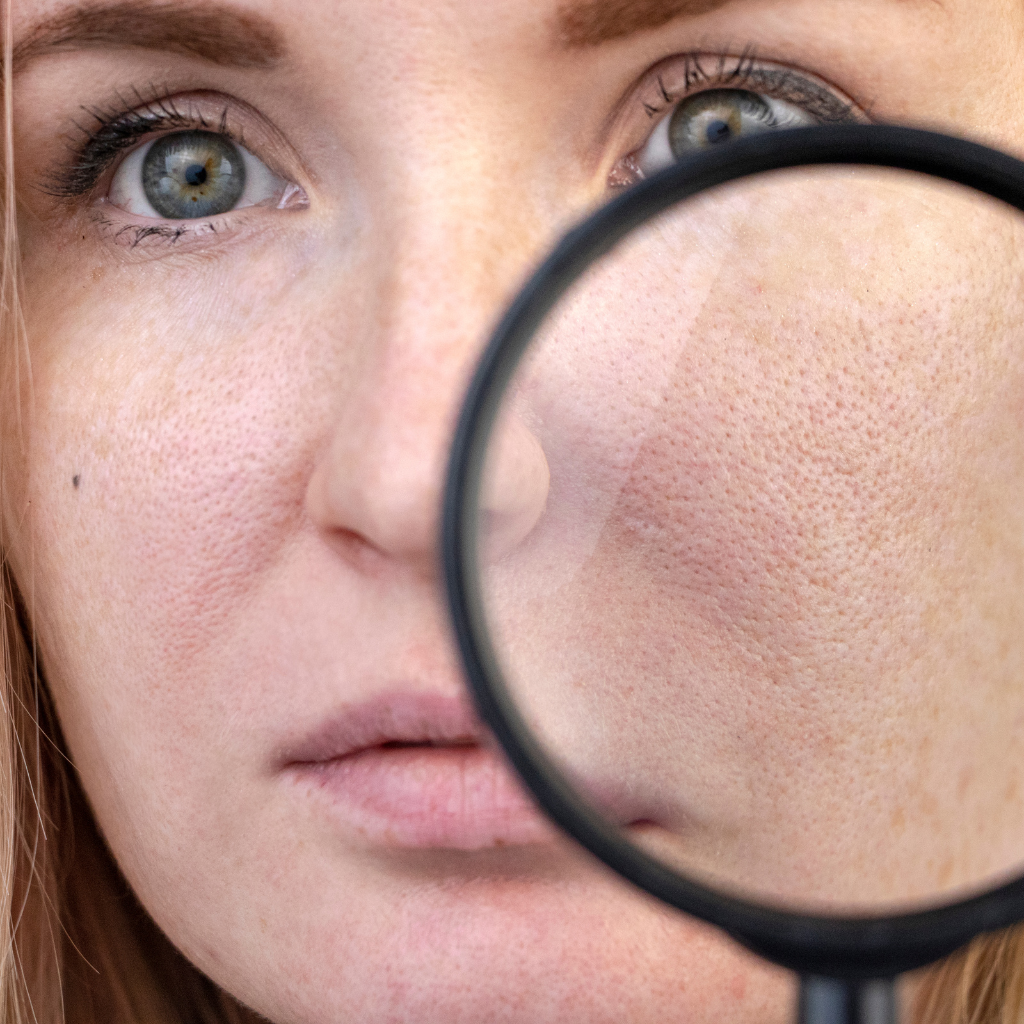 How to Get Rid of Open Pores on Face Permanently