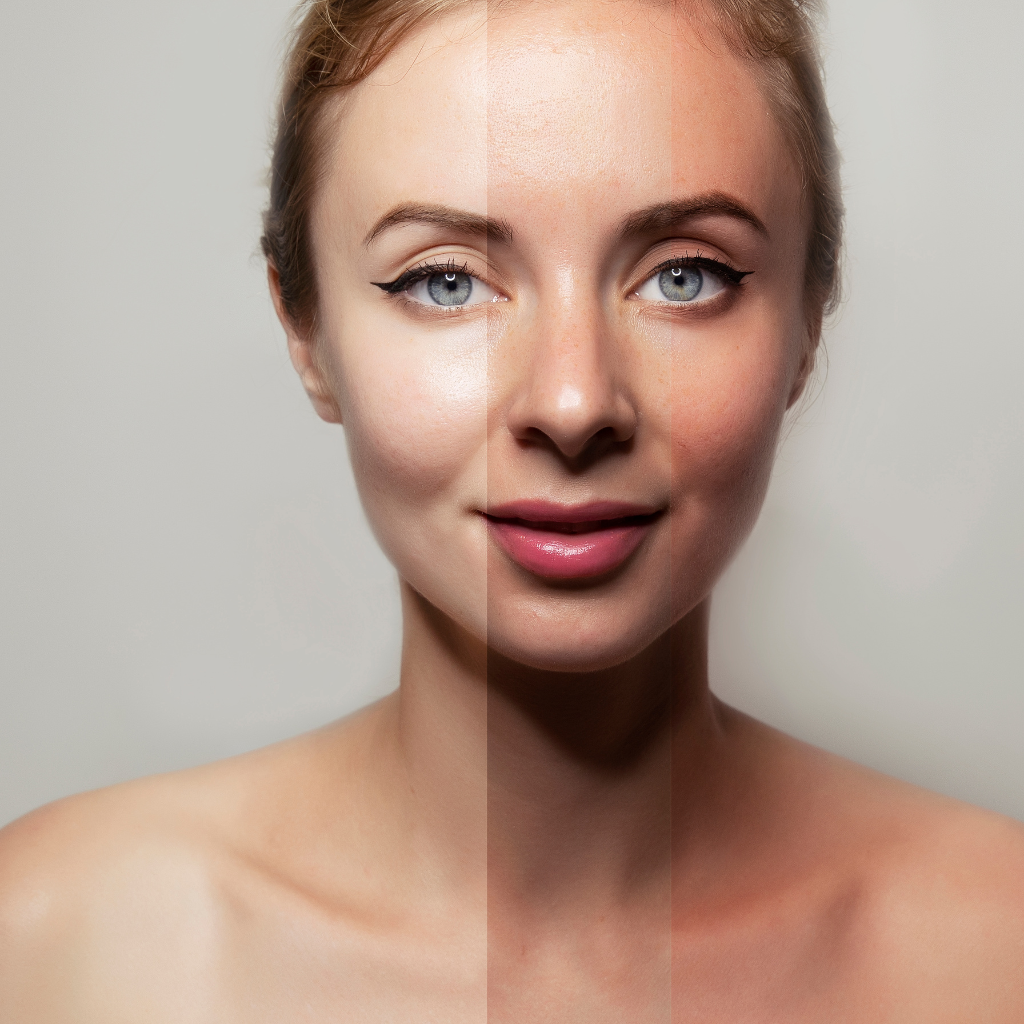 How to Protect Skin from Sun Tan: A Simple Guide