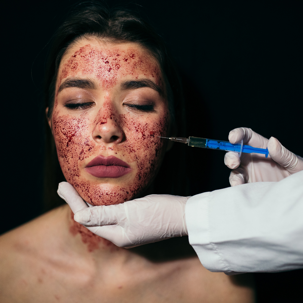 Vampire Facial Treatment: How This Facial Rejuvenates Your Skin