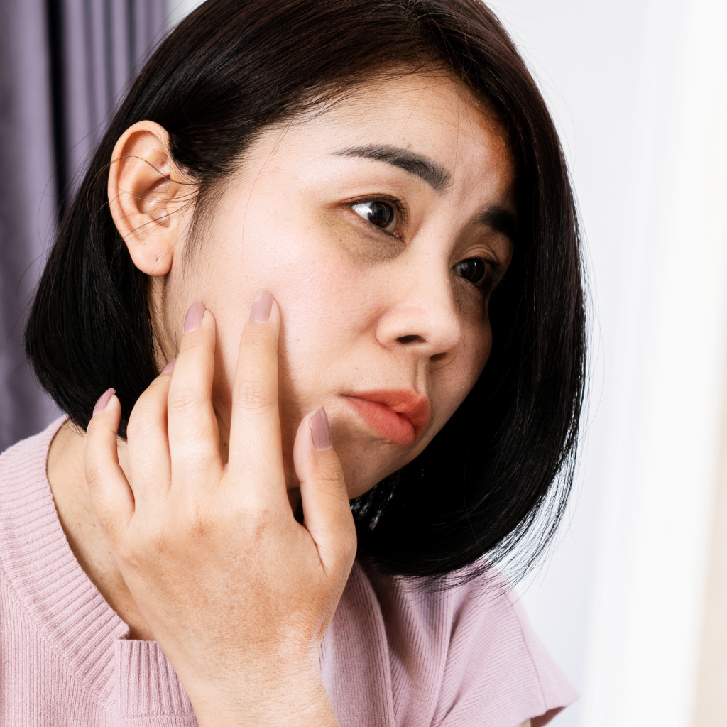 Can Botox Be Used Under the Eyes? Cost of Under-Eye Botox Explained