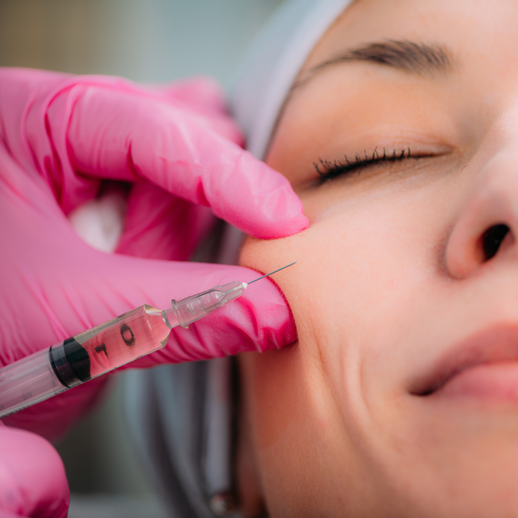 How to Inject Dermal Fillers in Cheeks for Youthful Contours